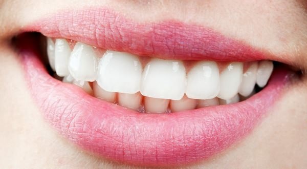 otbelivanie-zubov-v-domashnix-usloviyax (600x330, 46Kb)